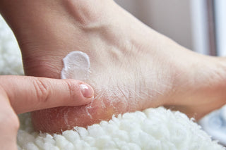 a female rubbing cream into her cracked heels