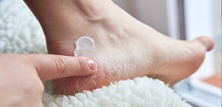 a female rubbing cream into her cracked heels
